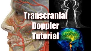 Transcranial Doppler Tecnique Anatomy amp Protocol [upl. by Bria]