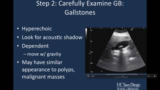 Bilirubin  Part 1 Metabolism amp Excretion [upl. by Enomal]