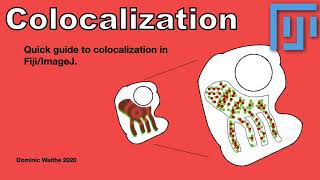 Quick guide to colocalization in FijiImageJ [upl. by Selmner]