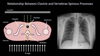 How to Interpret a Chest XRay Lesson 3  Assessing Technical Quality [upl. by Ailero]