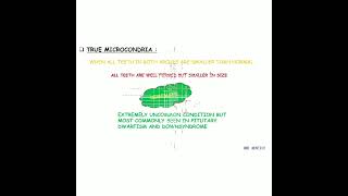 MICRODONTIA Causes Symptoms amp Treatment [upl. by Nieberg]