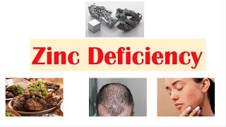 Zinc Deficiency  Dietary Sources Causes Signs amp Symptoms ex Hair Loss Diagnosis Treatment [upl. by Anoek]