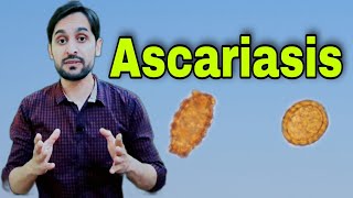 Ascariasis Infection  Ascaris Lumbricoides  Diagnosis  Life Cycle and Treatment [upl. by Airad]