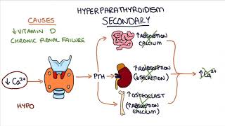 Understanding Hyperparathyroidism [upl. by Zacherie700]