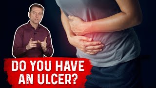 Understanding Ulcers How Do You Know If You Have One – Dr Berg [upl. by Elwira178]