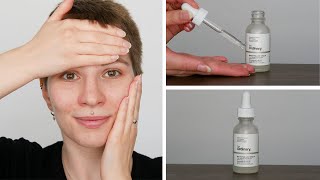 How to use The Ordinary Niacinamide 10  Zinc 1  Full Demonstration [upl. by Theall]