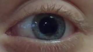 Eye Works 1 Focusing Cornea Iris and Lens [upl. by Anail]