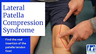 Patellofemoral Pain Syndrome Evaluation and Treatment [upl. by Laefar489]