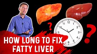 How To Reverse Fatty Liver Disease You May Have A Fatty Liver [upl. by Franciskus]