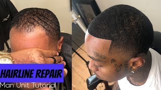 SHOCKING TRANSFORMATION Must see Hairline Repair Service  Best Man Unit Tutorial [upl. by Noid]