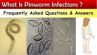 What Is Pinworm Infections   FAQ amp Answers [upl. by Festus]