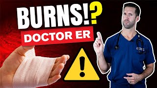 HOW TO TREAT A BURN — ER Doctor Explains Treating Burns Blisters Classifications amp Degrees [upl. by Gader699]