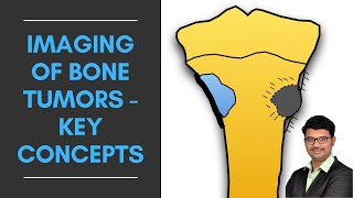 Imaging of Bone Tumors  Key Concepts  Dr Venkatesh Manchikanti ShadesofRadiology [upl. by Iy]