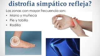 Sindrome de Sudeck  Recomendaciones de Rehabilitacion [upl. by Rochell]