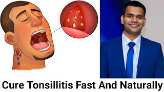 How To Cure Tonsillitis Fast And Naturally Powerful Home Remedies For Tonsil Stones That Works Fast [upl. by Renruojos]