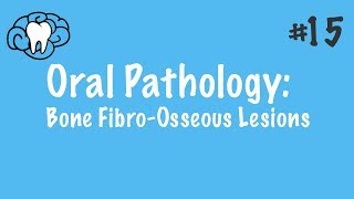 Oral Pathology  FibroOsseous Lesions  INBDE ADAT [upl. by Woothen471]