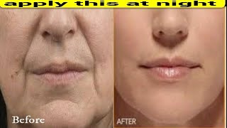 APPLY THIS AT NIGHT REMOVE DEEP MOUTH WRINKLES NEXT DAY [upl. by Aklim]