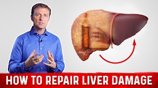 Fatty Liver Diet Proven to Reverse It NAFLD [upl. by Yeltihw393]