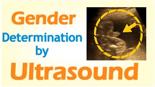 Gender Determination by Ultrasound [upl. by Eerised885]