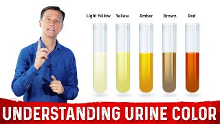 What Urine Color Indicates About Your Body – DrBerg [upl. by Joelie]