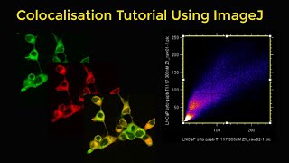 Colocalisation tutorial using ImageJ [upl. by Eitsud]