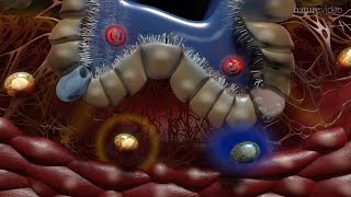 Oral Pathology  Mucosal Immunologic Diseases  INBDE ADAT [upl. by Yleek897]