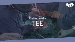 TEE MasterClass  Your introduction to TEE echocardiography [upl. by Colligan]