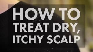 How to Treat a Dry Itchy Scalp  WebMD [upl. by Ttirrej]