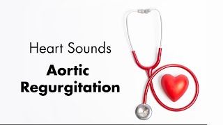 Aortic Regurgitation  Heart Sounds  MEDZCOOL [upl. by Ilhsa]