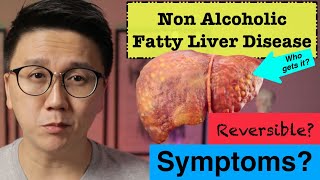 FATTY LIVER 5 Things You MUST Avoid  NAFLD  2024 [upl. by Aiym]