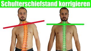 Schulterschiefstand beheben  Krumme Wirbelsäule  Brustkorb aufrichten [upl. by Donnenfeld]