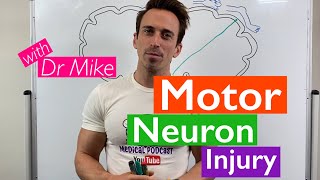 Motor Neuron Injury [upl. by Atirabrab]