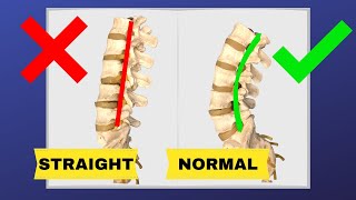 How To Correct Straightening Of Lumbar Spine FIX LOSS OF LUMBAR LORDOSIS  Dr Walter Salubro [upl. by Odel]