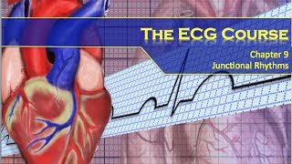 The ECG Course  Junctional Rhythms [upl. by Legnaleugim786]