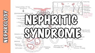 Nephritic Syndrome  classification pathophysiology treatment RPGN ANCA Immune complex [upl. by Lazare516]