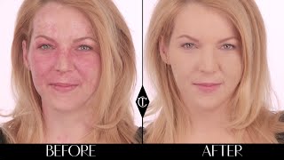 How to cover up birthmarks Charlotte Tilbury Magic Foundation Makeup Tutorials [upl. by Kaehpos406]