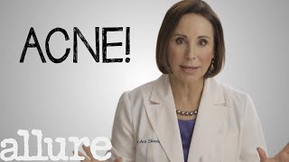 What is Acne and How Do I Get Rid of it Forever  Allure [upl. by Aziar]