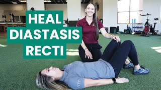 Exercises to Fix Your Diastasis Recti  Physical Therapy [upl. by Aitnwahs828]