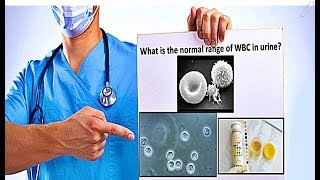 WBC in Urine  High Count Causes [upl. by Chaiken131]