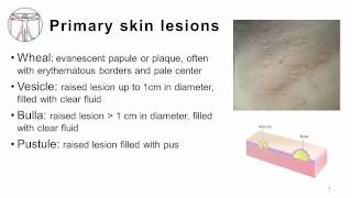 4 Primary and Secondary skin lesions [upl. by Ssor339]